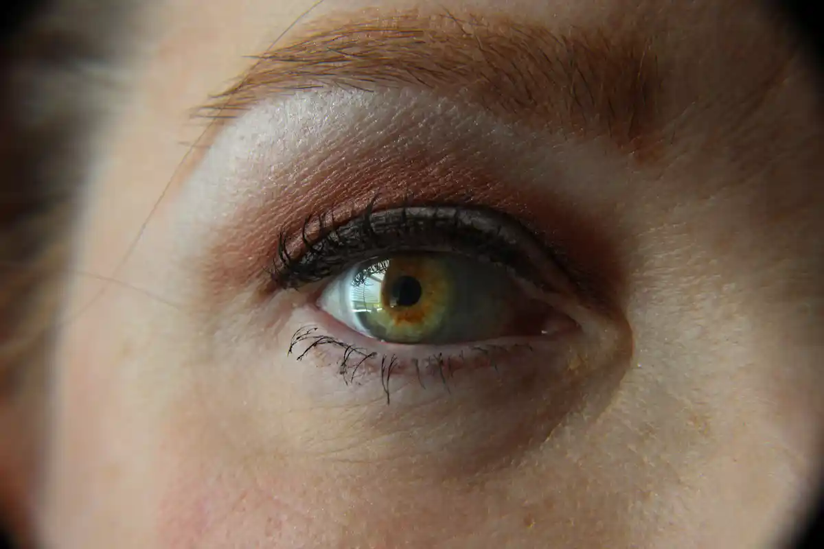 Auge