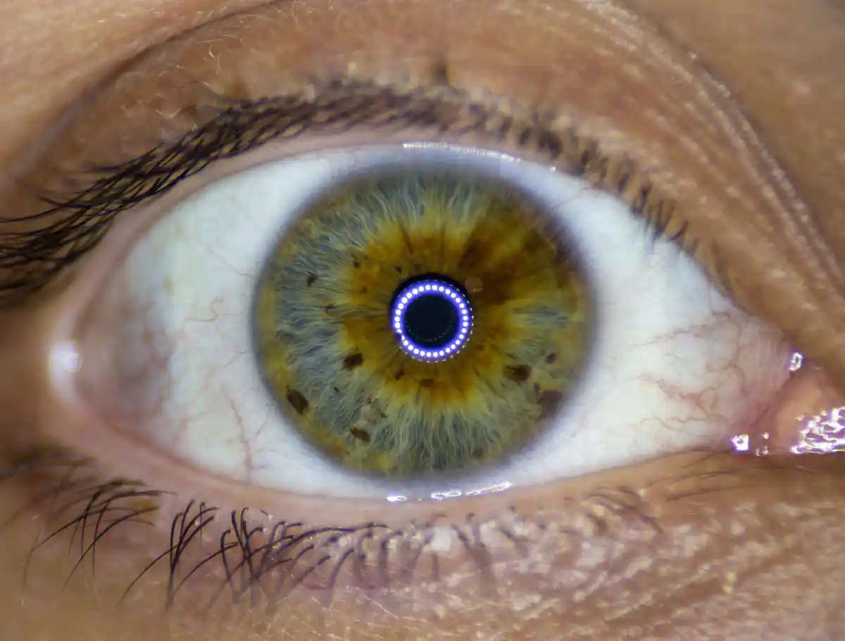 Auge